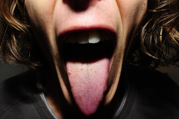 guy with open mouth showing his tongue