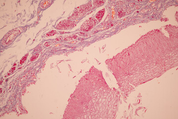 Showing Light micrograph of the Tongue human , Tooth human, Parotid  gland human and Oesophagus human under the microscope for education in the laboratory.