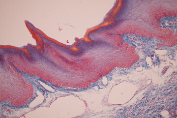 Showing Light micrograph of the Tongue human , Tooth human, Parotid  gland human and Oesophagus...
