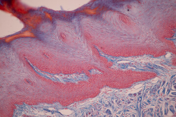 Showing Light micrograph of the Tongue human , Tooth human, Parotid  gland human and Oesophagus human under the microscope for education in the laboratory.