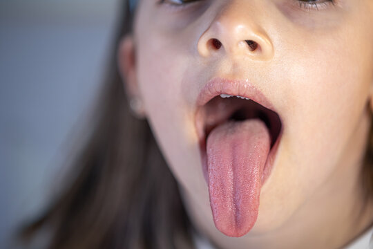 A child girl open her mouth and show her tounge.