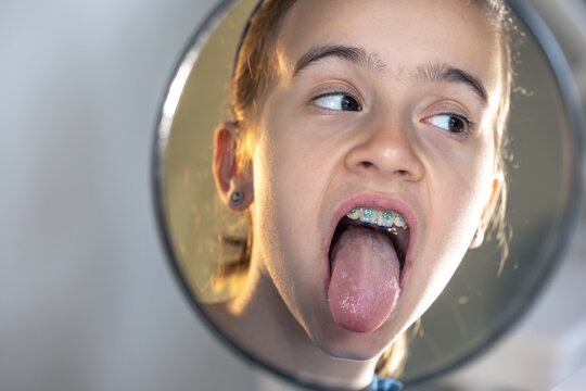 Caucasian girl with braces on her teeth looking at the mirror.