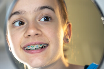 Caucasian preteen girl with braces on her teeth looking at the mirror.