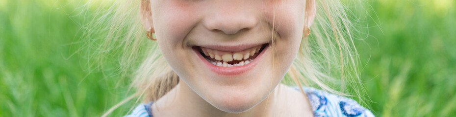 Smile and teeth of a 7-year-old girl close-up. Paediatric dentistry.