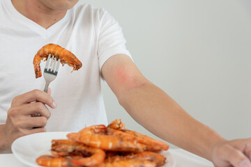 food allergies, men have reactions itching and redness after eating shrimp, seafood allergy,...