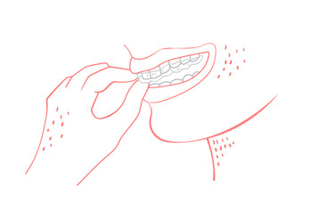 Orthodontic silicone trainer. Invisible braces retainer. Vector illustration