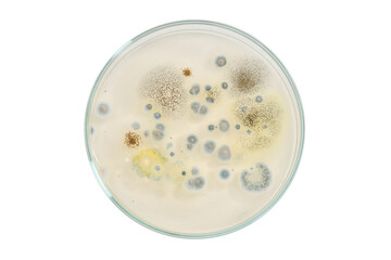 Yeast and Mould Test. biodiversity. Microbiology. Colony morphology of Yeast and mould. Fungal colony morphology. Fungal growth in DG18. Dichloran Glycerol media. Incubated plates. Fungi. Microbia