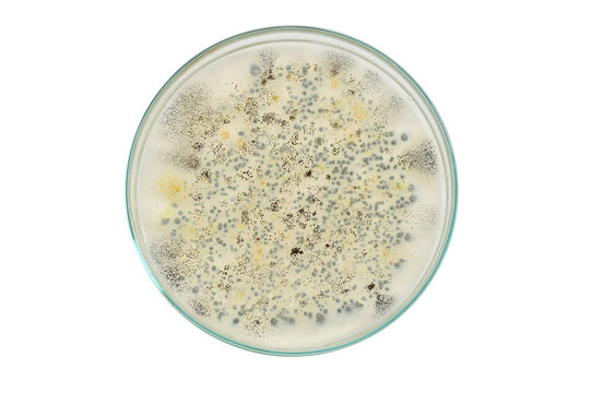 Colony morphology of Yeast and mould. Fungal colony morphology. Fungal growth in DG18. Dichloran Glycerol media. Incubated plates