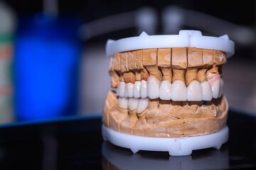 Zirconium Porcelain Tooth plate