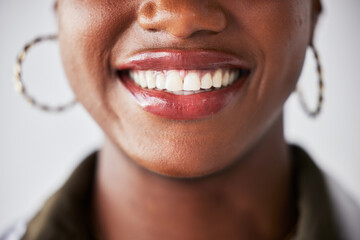 Smile, happy and mouth closeup of black woman with teeth whitening, dental care and wellness. Healthcare, dentistry and face zoom of female person with cleaning for hygiene, grooming and treatment