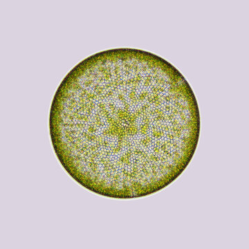 Coscinodiscus is a species of diatom which belongs to a group of ocean algae—phytoplankton. Coscinodiscus is photosynthetic using light to produce organic matter.