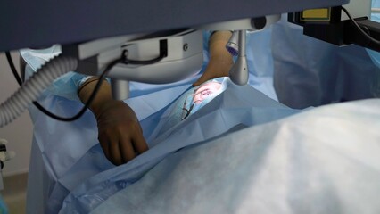 Ophthalmic operation. Surgeon's hands in gloves performing laser vision correction. Close-up of the...