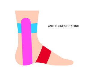Kinesiology therapeutic tape