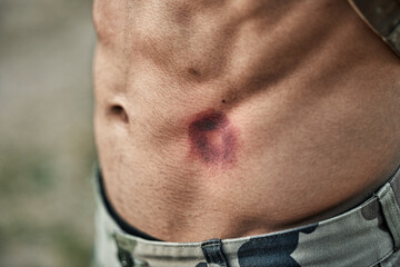 Paintball injury, stomach bruise and man in closeup with pain, shooting or accident for outdoor war...