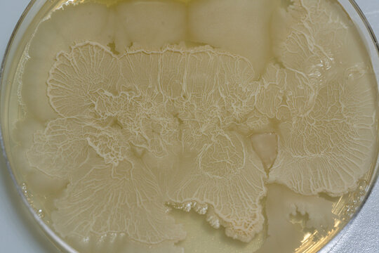 Close up media plate with bacteria culture and drug resistance of pathogens.Microbacterial growing in petri dishes on agar gel scientific experiment.Mold and fungal cultures.Microbiological laboratory