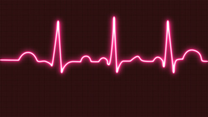 Normal heartbeat line on electrocardiogram (Sinus rhythm). ECG. EKG. indication of life. healthcare symbol in medicine.