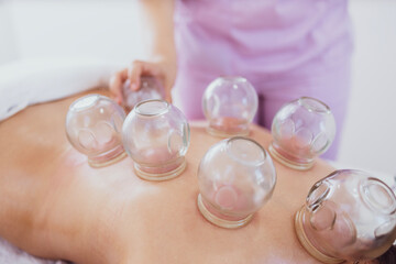 Hijama therapy with heated vacuum cups on patient skin to heal pain problems.