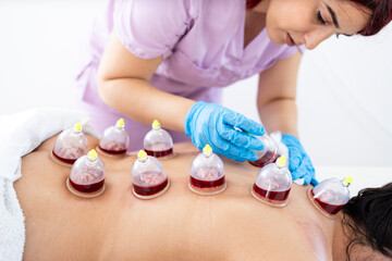 Hijama expert performs a vacuum blood suction procedure on patient skin.