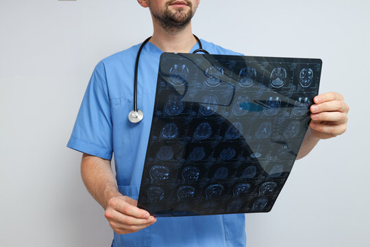 MRI images of a human head in the hands of a doctor