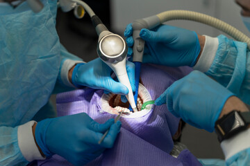 Portrait of patient with open mouth, selective focus on hands of dentist, treatment teeth