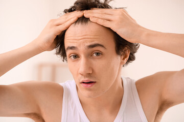 Young man with hair loss problem in bathroom, closeup - obrazy, fototapety, plakaty