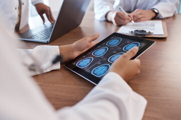 Doctor, tablet screen and hands of person with brain scan MRI, cancer tumor results and consulting on digital xray data. Closeup teamwork, radiology and neurosurgeon collaboration on anatomy exam