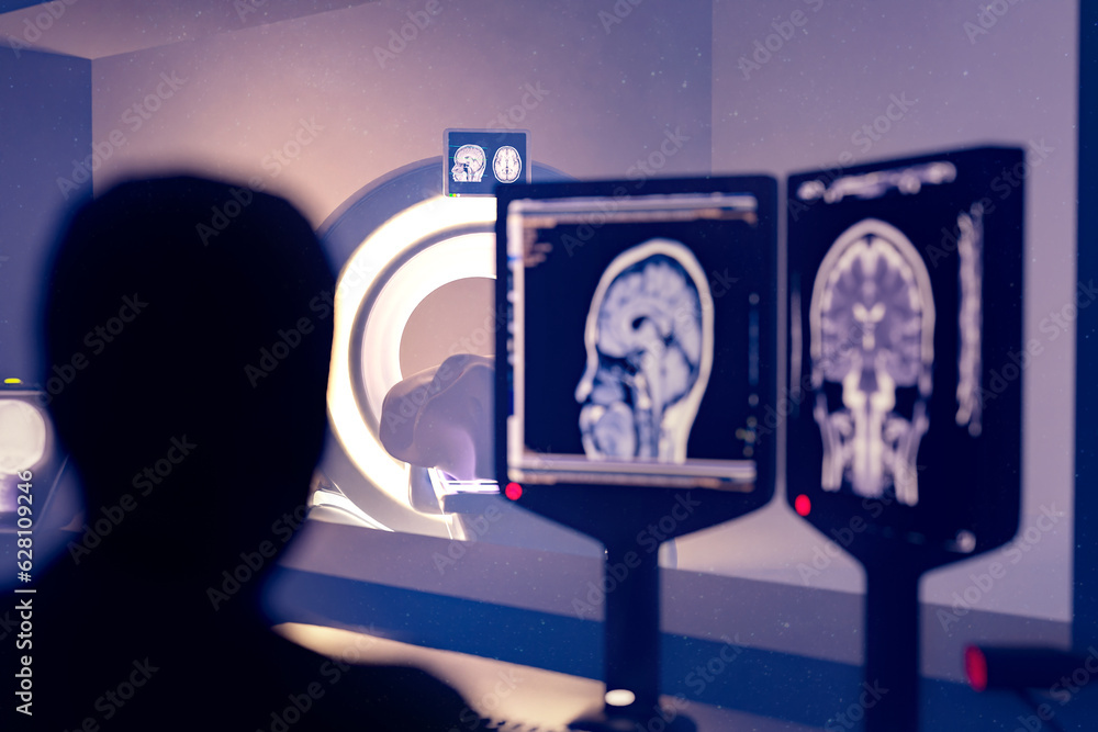 Poster in control room radiologist diagnosis while watching procedure and monitors showing brain scans resu