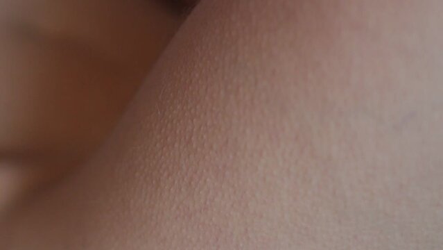 Goosebumps appear on the body of the girl