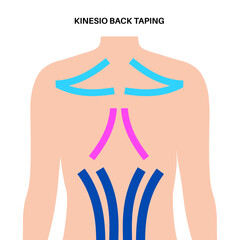 Kinesiology therapeutic tape