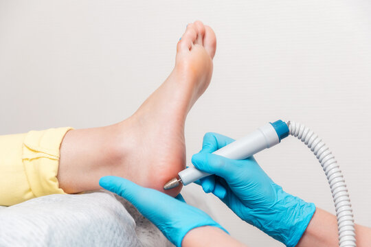 Podologist does hardware peeling of the skin of the heel. Close-up of smooth foot and master's arms. The concept of professional pedicure and chiropody