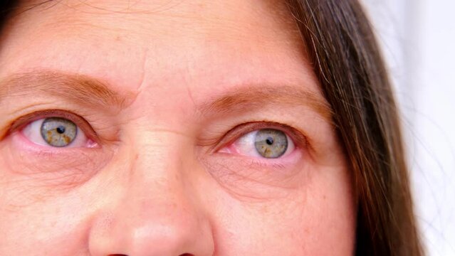 close up part of mature female face, woman 50-55 years old, tired eyes, allergies, deep wrinkles, age-related skin changes, wrinkles around eyes, overhang, concept of cosmetic anti-aging procedures
