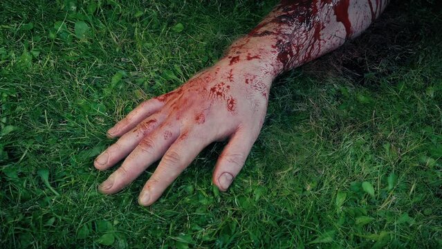Bloody Arm On The Ground, Accident, Injury
