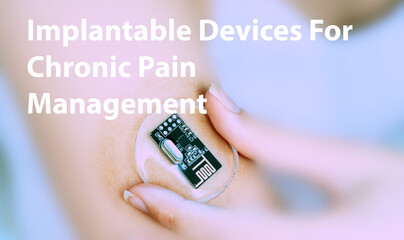 Implantable Devices For Chronic Pain Management Implantable Electronic