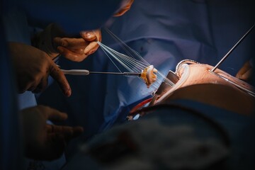 Team of medical professionals performing surgery on a patient.