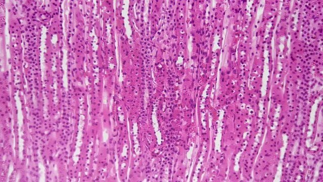 Human kidney with blood vessel injected in section filmed under microscope 200x on bright field background. Macro footage of tissue of filtering organ in people organism. Research of urinary system