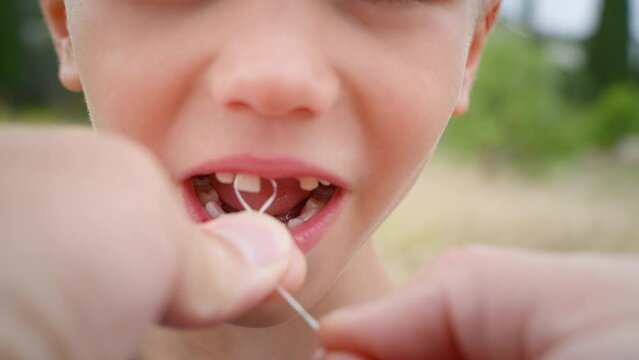 An attempt to pull out the boy's front milk tooth with a thread. 