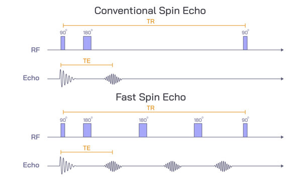 Gradient echo sequences, radiology reference article images, MRI physics, Pulse sequence rephasing and de phase gradient decay. Recalled echo. RF, Slice, Phase, readout, echo, time.