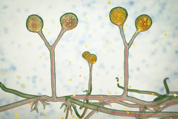 Rhizomucor fungi, 3D illustration. Filamentous fungi commonly found in soil, the causative agent of mucormycosis in humans