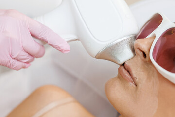 The cosmetologist does the procedure for laser hair removal of unwanted hair of the face to a young...