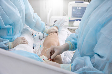 Surgical treatment varicose veins in hospital by team vascular surgeons by Radiofrequency ablation. Surgeon in operating room inserts catheter into vein on patient's lower limb treat varicose veins - obrazy, fototapety, plakaty