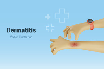 Dermatitis, allergy and medical skin problem. Hand scratching on itchy arm. Medical and health care. 3D vector cartoon character.