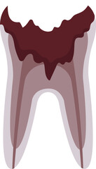 Dead Tooth Problem
