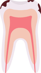Caries Tooth Problem