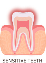 Sensitive Tooth Problem