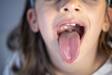 A child girl open her mouth and show her tounge.