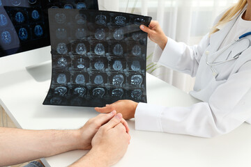 The doctor shows the tumor to the patient on MRI images of the head