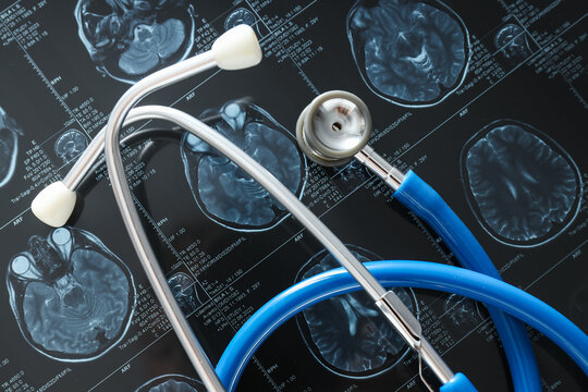 MRI or magnetic resonance imaging of the head and brain with a stethoscope. Close up