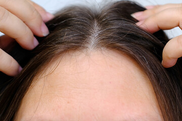 Aging with grace and confidence, brown-haired woman with long brown hair with gray hair, female forehead close-up, hands hold strands of hair, Hair care and grooming for mature women
