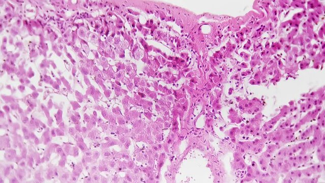 Macro footage of liver vessel injection in section under microscope 200x on bright field background. Isolated slide of organ serving for detoxification and metabolism. Tissue prepared for examination