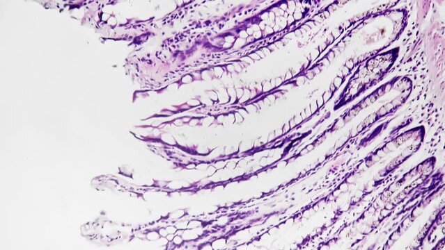 Human colon in section filmed under medical 200x microscope in hospital laboratory for healthcare check. Oncology screening of digestive system organ. Looking for tumor or other illness to prevent it.